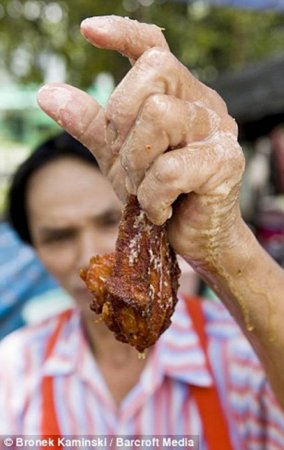 Kann Superhands ( ) Trichan -     (10  + 1 )